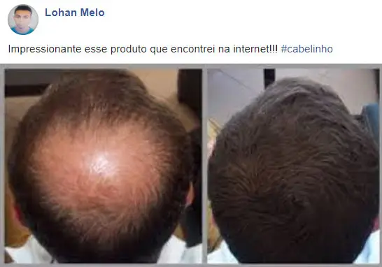 Cabelo de Deusa antes e depois - Lohan Melo